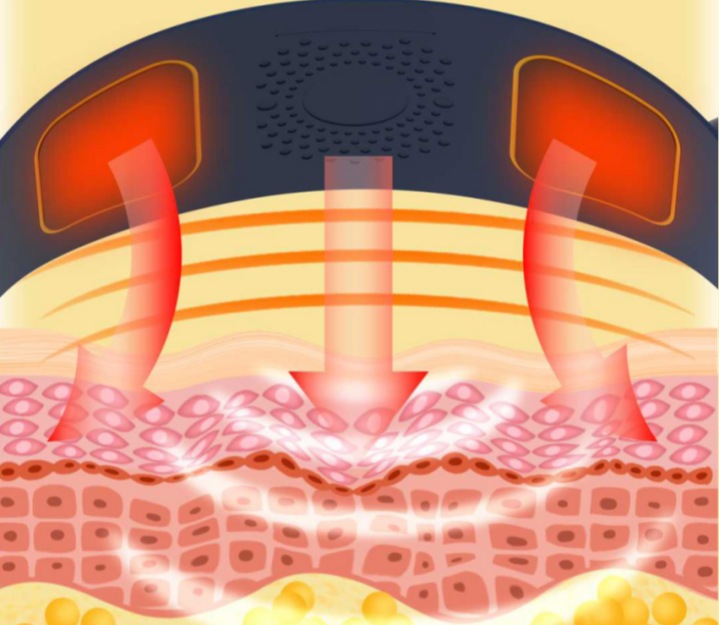 The Science behind Self-Heating Wormwood Waist Belts: How Do They Work?